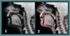 image: Use of ultrasound scans in Dynamic Dialects: (1) mid-sagittal MRI frame of the model-talker’s head, (2) animation rig superimposed on the MRI frame